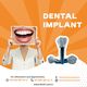 Dental Implant