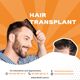 Hair Transplant