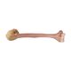 Massive Distal Humerus. All Sizes