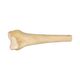 Massive Distal Femur. All Sizes