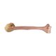 Massive Proximal Humerus