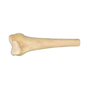 638258772209040475masif-distal-femur.jpg